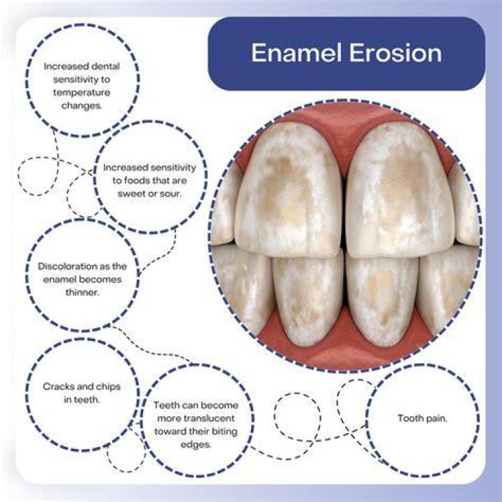 Can eroded enamel be restored?