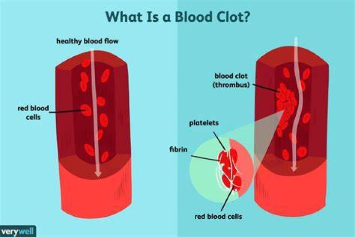 Can fenugreek cause blood clots?