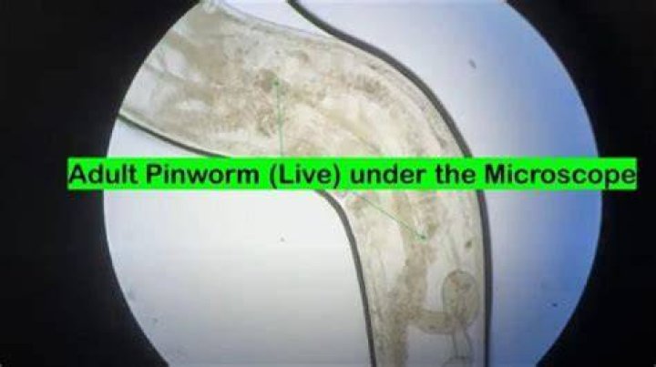 Can pinworms live in your mouth?