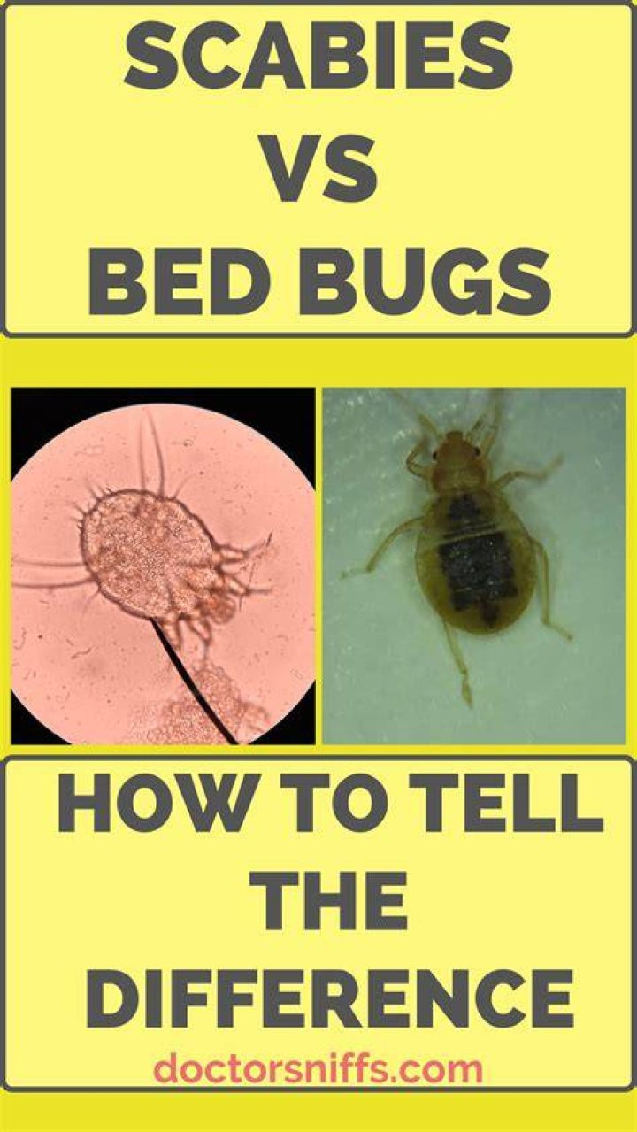 Can scabies live in pillows?