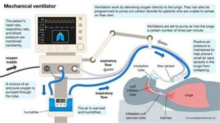 Do you gag on a ventilator?