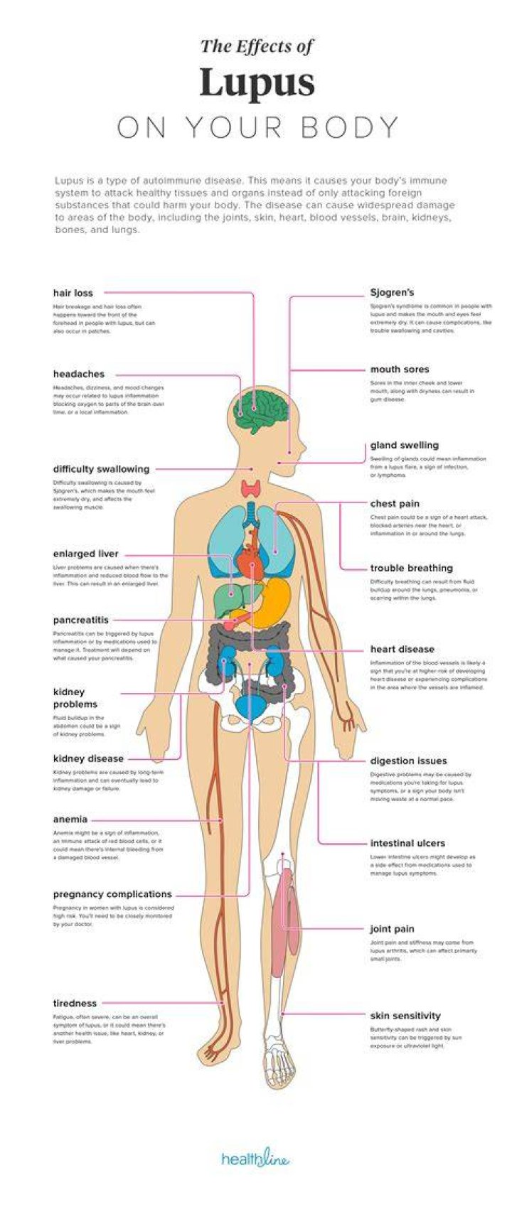 Does lupus affect your mind?