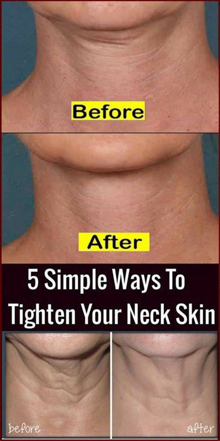 How can I tighten loose skin on my neck?