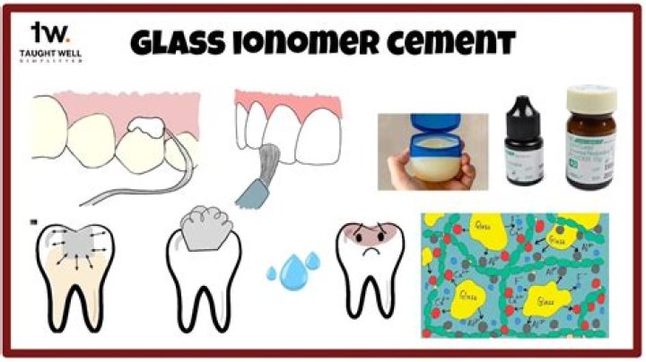 How long does glass ionomer last?