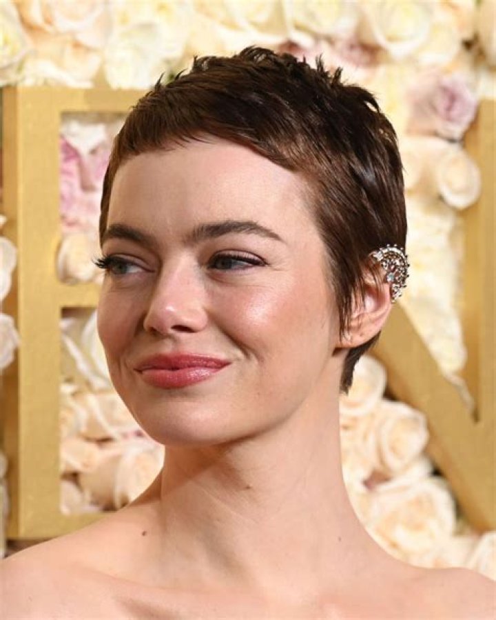 What do celebrities do for thinning hair?