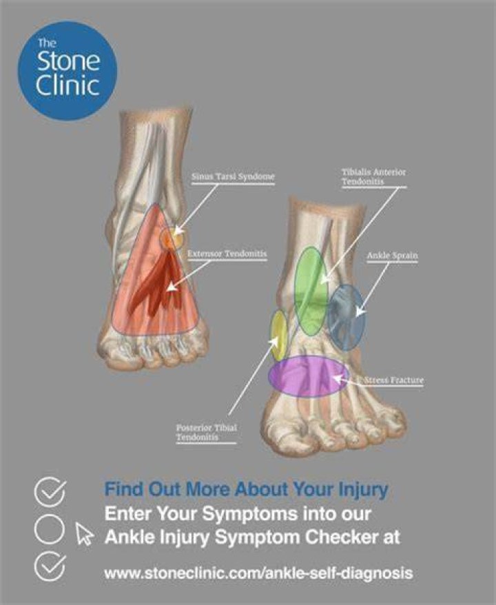 What does an anchor on the ankle mean?