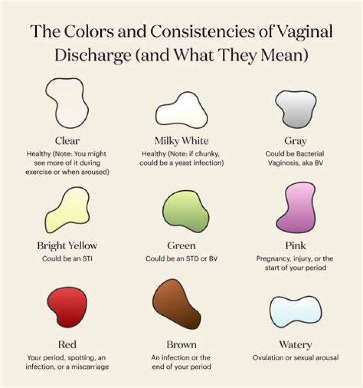 What does creamy discharge mean?