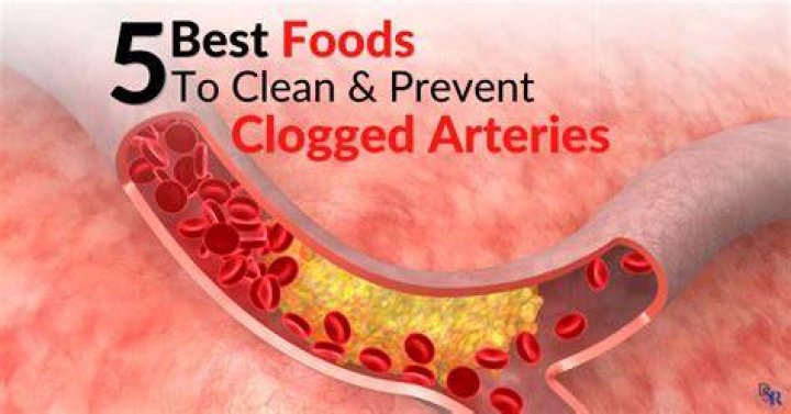 What foods clean clogged arteries?