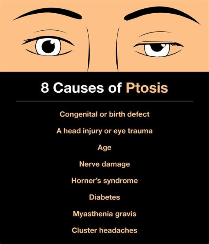 What is the most common cause of ptosis?