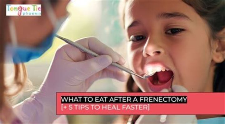When can I eat normal food after frenectomy?