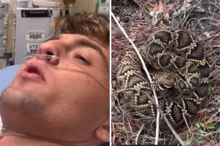 Who gets bit by snakes the most?