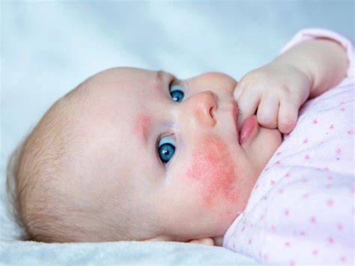 Why is my baby red?